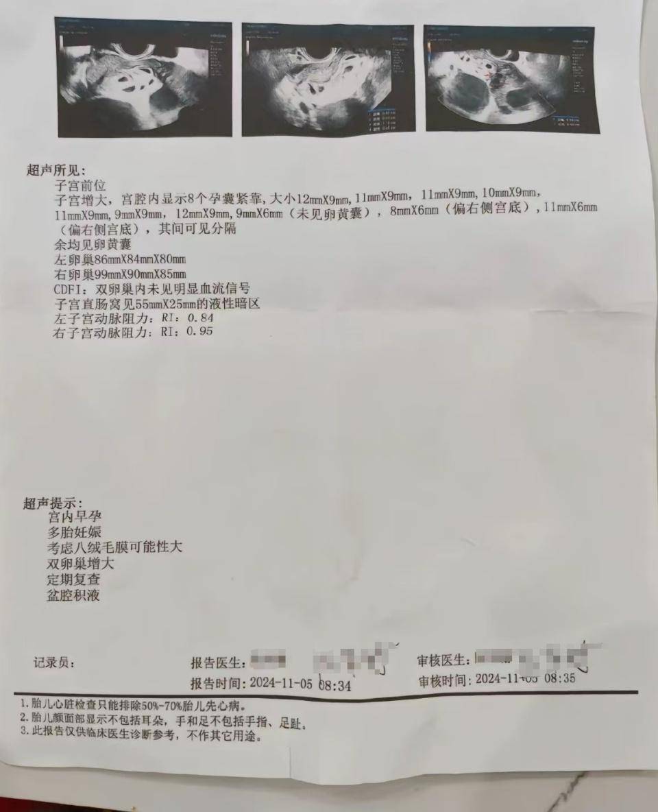 怀上9胞胎女子今日进行减胎手术：分两次进行<strong></p>
<p>亿发虚拟币</strong>，第一次减去四个胚胎，第二次减去三个