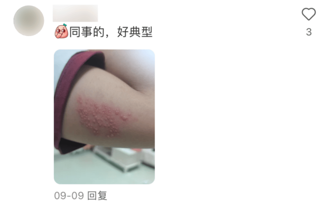 一旦感染终身携带<strong></p>
<p>亿发虚拟币</strong>！深圳疾控提醒：这4类人要注意