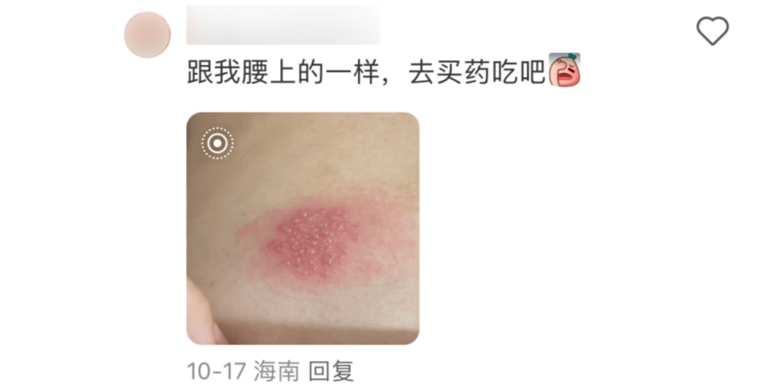 一旦感染终身携带<strong></p>
<p>亿发虚拟币</strong>！深圳疾控提醒：这4类人要注意