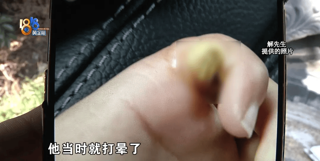 5岁男童瞬间晕厥<strong></p>
<p>jb虚拟币</strong>，筋都断了！街上常见，看见立即远离