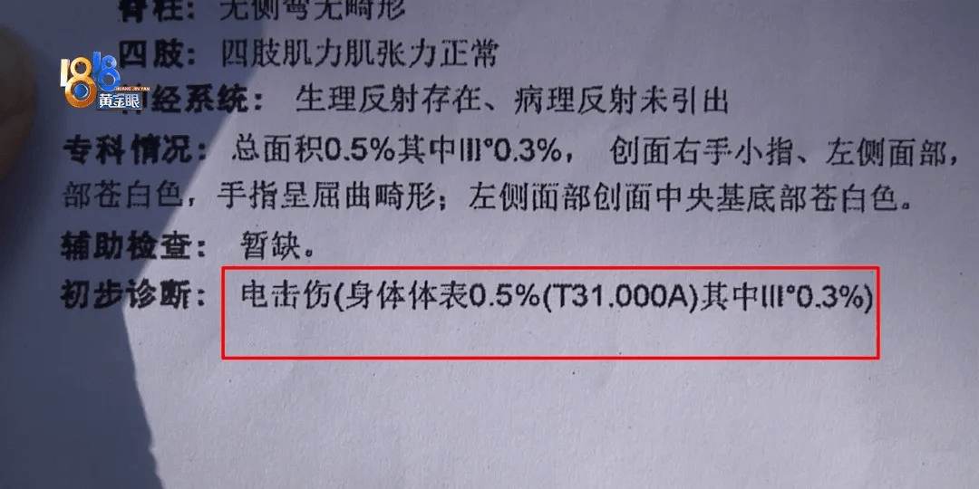 5岁男童瞬间晕厥<strong></p>
<p>jb虚拟币</strong>，筋都断了！街上常见，看见立即远离