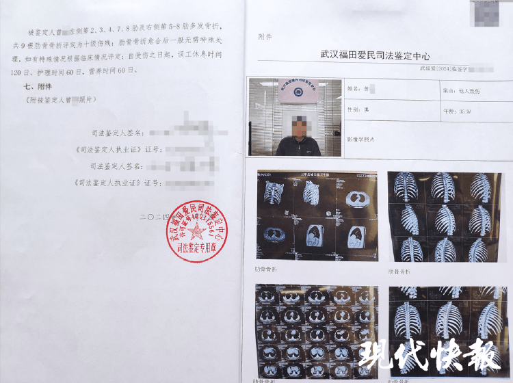 湖北一男子称被交警打断9根肋骨未立案<strong></p>
<p>虚拟榴莲币</strong>，警方回应