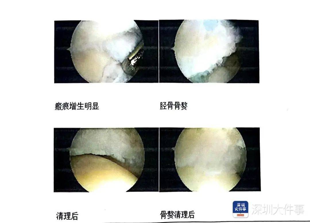 “一走路就痛”！女子脚踝受伤遭漏诊<strong></p>
<p>mk虚拟币</strong>，治了7年没好！深圳一医院被告上法庭