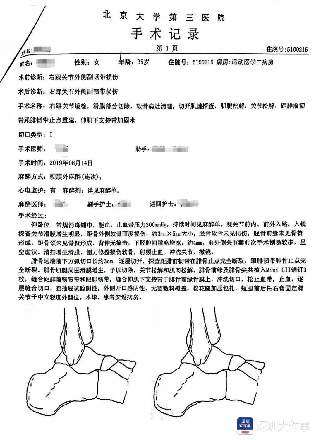 “一走路就痛”！女子脚踝受伤遭漏诊<strong></p>
<p>mk虚拟币</strong>，治了7年没好！深圳一医院被告上法庭