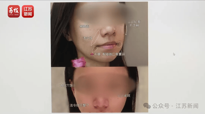 打一针“返老还童”的童颜针卖了30亿<strong></p>
<p>盗币虚拟币</strong>，真的有效吗？