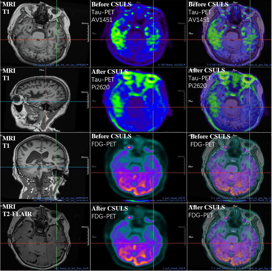 300多家医院抢着做的手术<strong></p>
<p>虚拟币提款</strong>，为何突被禁？