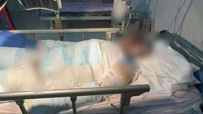 父子在哈尔滨一亲戚公司上班遇爆炸全身烧伤<strong></p>
<p>数字货币套利</strong>，治疗花费近百万公司拒赔偿？亲戚回应