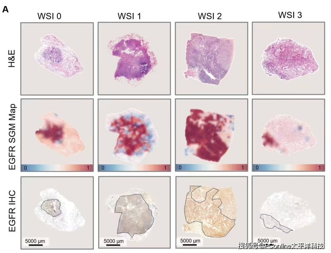 准确率高达 99%<strong></p>
<p>国际数字货币</strong>！腾讯 AI 可预测肺癌基因突变