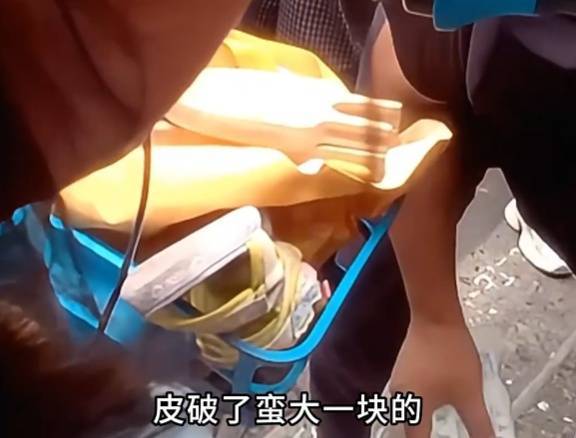 看着都疼<strong></p>
<p>如何交易数字货币</strong>！上海街头一男子突然求助：10岁女儿被死死卡住！这个行为太危险→